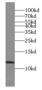PPDPF antibody|PPDPF抗体