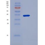 小鼠CD5分子(CD5)重组蛋白His Tag