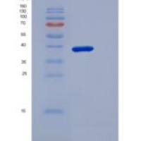 小鼠CD5分子(CD5)重组蛋白His Tag