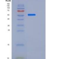 人PDGFRa / CD140a重组蛋白