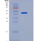 人CHI3L1 / YKL40重组蛋白His tag