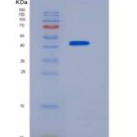 人CHI3L1 / YKL40重组蛋白His tag