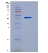 人CHI3L1 / YKL40重组蛋白His tag