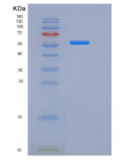人纤连蛋白亮氨酸丰富跨膜蛋白2(FLRT2)重组蛋白His 