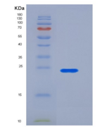 人2B4 / SLAMF / CD244重组蛋白His ta
