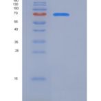 小鼠TrkA / NTRK1重组蛋白Fc tag