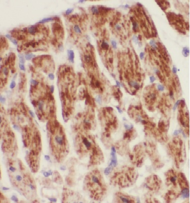 DBI antibody|DBI抗体