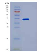 小鼠CD5分子(CD5)重组蛋白His Tag