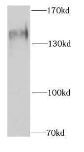 SF3B3 antibody|SF3B3抗体