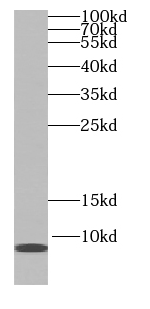 SS18L2 antibody|SS18L2抗体
