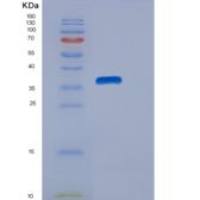 小鼠EGF样域半胱氨酸丰富蛋白1(CRELD1)重组蛋白His tag