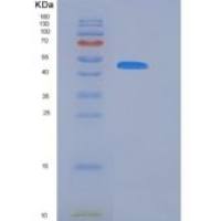 小鼠丝氨酸蛋白酶抑制剂A11(SERPINA11)重组蛋白His tag