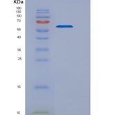 人磷脂酰肌醇蛋白聚糖5(GPC5)重组蛋白His tag