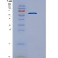 人磷脂酰肌醇蛋白聚糖5(GPC5)重组蛋白His tag