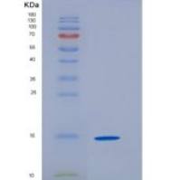 小鼠TRAIL R2 / CD262 / TNFRSF10B重组蛋白His tag
