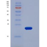 人CLEC1B / CLEC2重组蛋白His tag