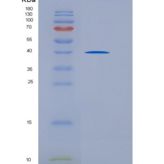 人CD5分子(CD5)重组蛋白His tag
