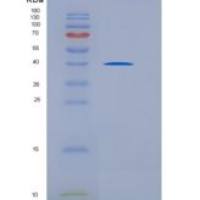 人CD5分子(CD5)重组蛋白His tag
