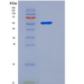 小鼠CLEC10A / MGL1 / CD301重组蛋白Fc tag