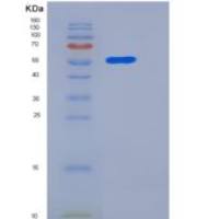 小鼠CLEC10A / MGL1 / CD301重组蛋白Fc tag