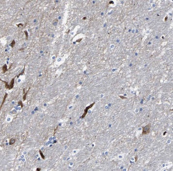 PSG11 antibody|PSG11抗体