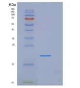人DUSP3 / VHR重组蛋白
