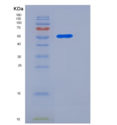 小鼠CLEC10A / MGL1 / CD301重组蛋白Fc