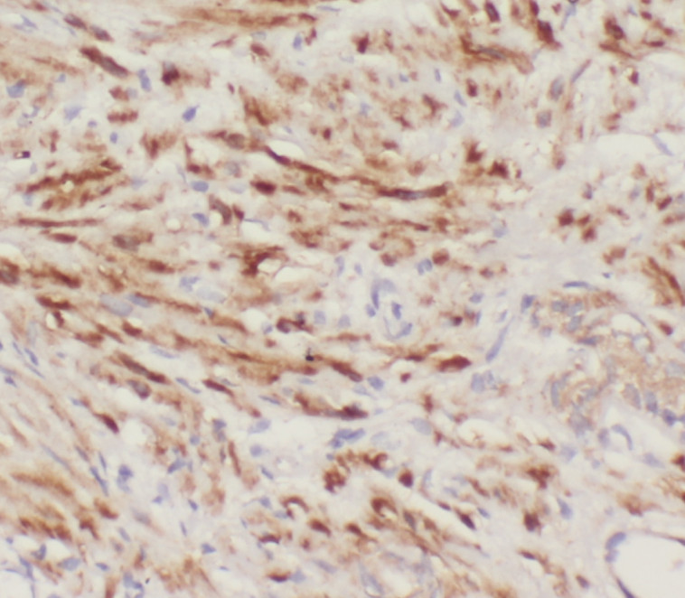 SPCS1 antibody|SPCS1抗体