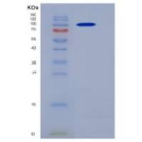 人beta-Catenin / CTNNB1重组蛋白His & GST tag