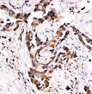 BCL2L10 antibody|BCL2L10抗体