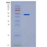 人Coagulation Factor X / FX / F10重组蛋白His tag