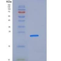 人SOD2 / Mn-SOD重组蛋白