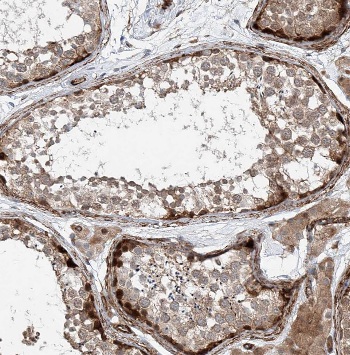 AK8 antibody|AK8抗体