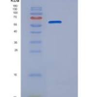 人TLR2 / CD282重组蛋白aa 1-587, His tag