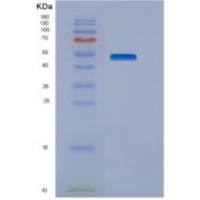 人ENTPD3 / NTPDase3 / CD39L3重组蛋白His tag