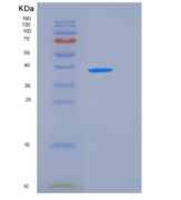 人ALK4 / ACVR1B重组蛋白His & Fc tag