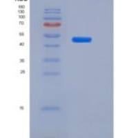 人血红素结合蛋白(HPX)重组蛋白His tag