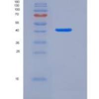 人白细胞关联免疫球蛋白样受体1(LAIR1)重组蛋白Fc Tag