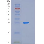 人Syndecan-1 / SDC1 / CD138重组蛋白His tag