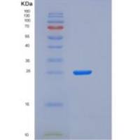 人Syndecan-1 / SDC1 / CD138重组蛋白His tag