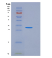 人Cathepsin V / Cathepsin L2 / 