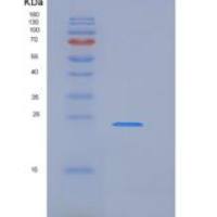 人CD84重组蛋白His tag