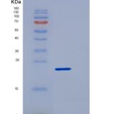 人髓细胞触发受体1(TREM1)重组蛋白His tag