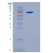 人IL6ST / gp130 / CD130重组蛋白