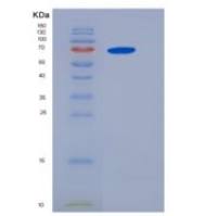 人IL6ST / gp130 / CD130重组蛋白