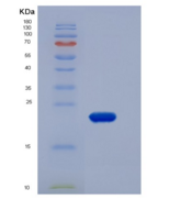 人CLEC1B / CLEC2重组蛋白His tag