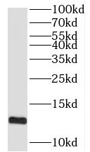 SPCS1 antibody|SPCS1抗体