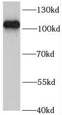 R3HCC1L antibody|R3HCC1L抗体