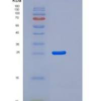 人杀伤细胞免疫球蛋白样受体2DL3(KIR2DL3)重组蛋白His Tag