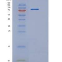 小鼠OSMR / IL-31RB重组蛋白His tag